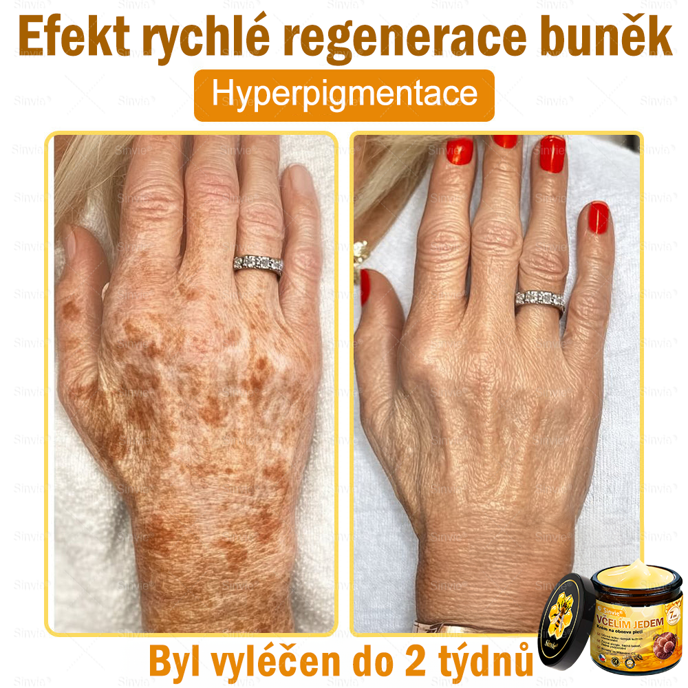 🌻🌻 🌻Sinvie® Krém na obnovu pleti s včelím jedem 🔥 Doporučeno dermatology | Proti vráskám, pigmentovým skvrnám a ochablé pleti - 50 ml