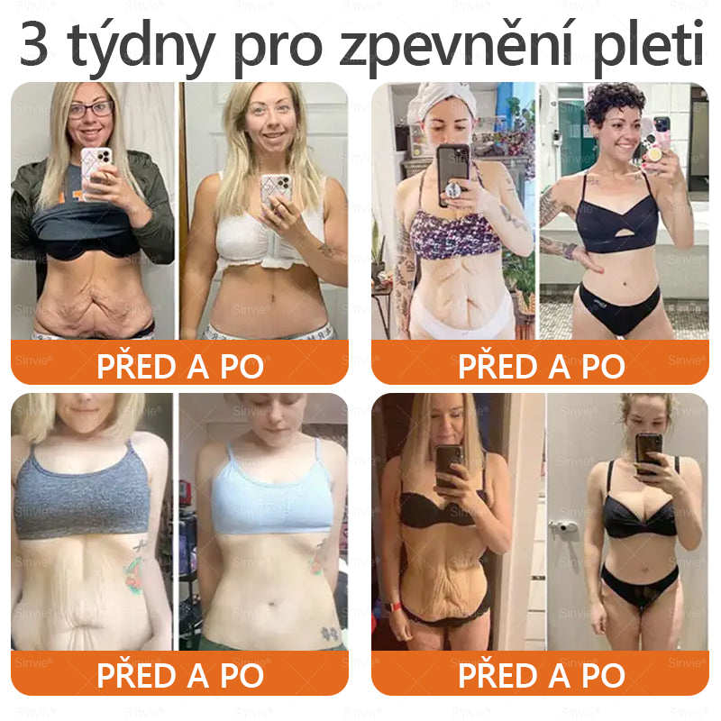 🐝 Sinvie® Krém na obnovu pleti s včelím jedem 👨‍⚕ Doporučeno dermatology ✅GMP schváleno - 50ml
