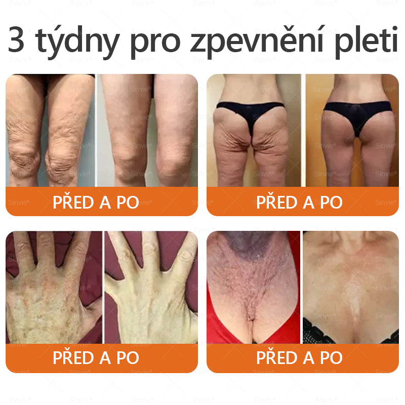 🌻 🌻Sinvie® Krém na obnovu pleti s včelím jedem 🔥 Doporučeno dermatology | Proti vráskám, pigmentovým skvrnám a ochablé pleti - 50 ml