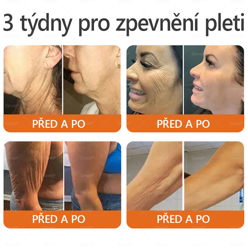 🌻 🌻Sinvie® Krém na obnovu pleti s včelím jedem 🔥 Doporučeno dermatology | Proti vráskám, pigmentovým skvrnám a ochablé pleti - 50 ml