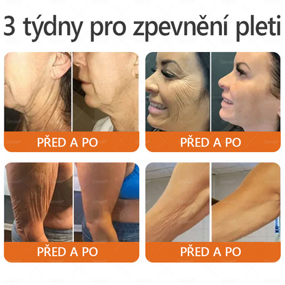 🌻 🌻Sinvie® Krém na obnovu pleti s včelím jedem 🔥 Doporučeno dermatology | Proti vráskám, pigmentovým skvrnám a ochablé pleti - 50 ml
