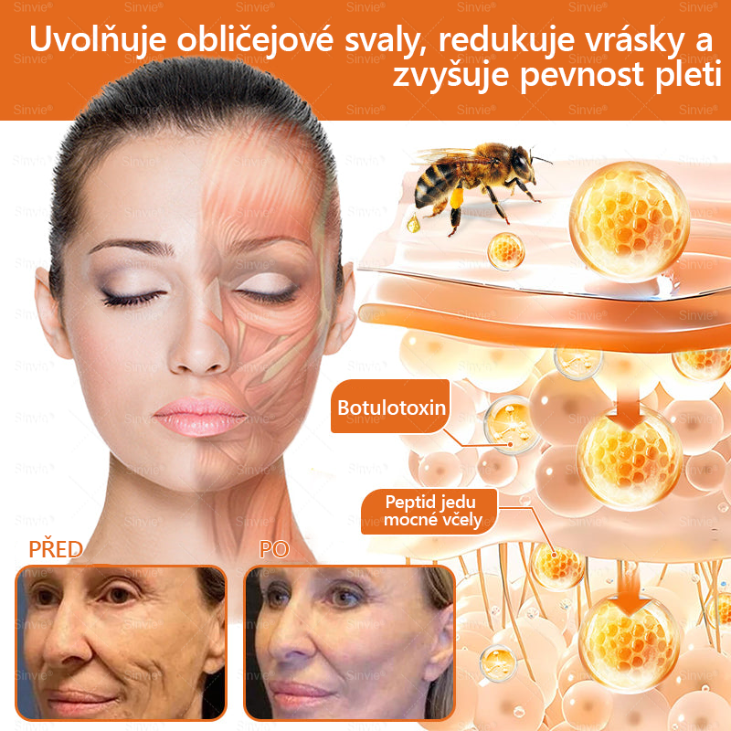 🐝 Sinvie® Krém na obnovu pleti s včelím jedem 👨‍⚕ Doporučeno dermatology ✅GMP schváleno - 50ml
