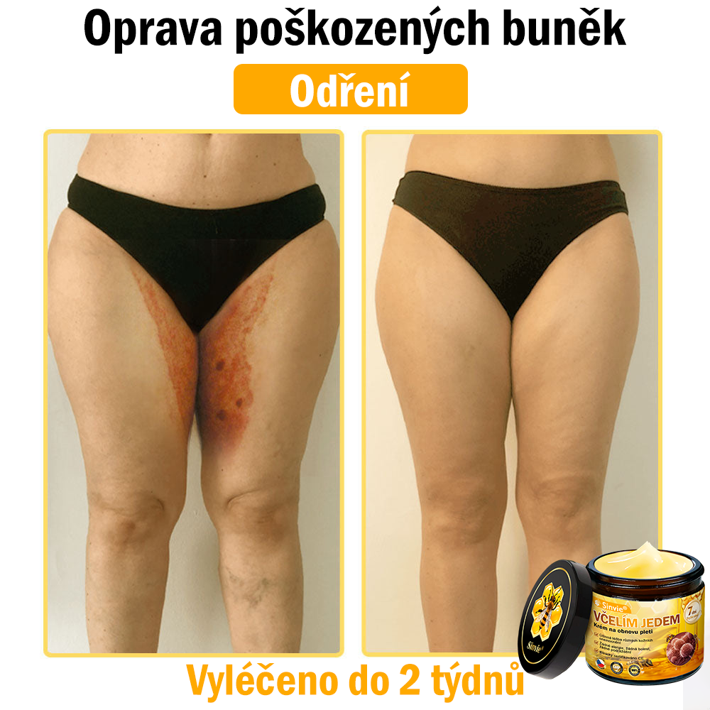 🐝 Sinvie® Krém na obnovu pleti s včelím jedem 👨‍⚕ Doporučeno dermatology ✅GMP schváleno - 50ml
