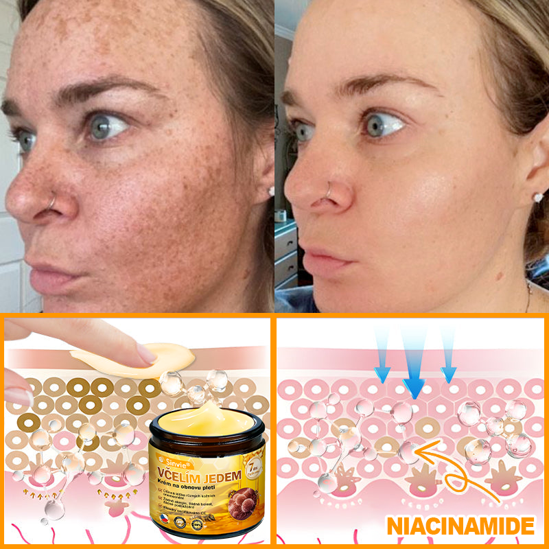 🐝 Sinvie® Krém na obnovu pleti s včelím jedem 👨‍⚕ Doporučeno dermatology ✅GMP schváleno - 50ml