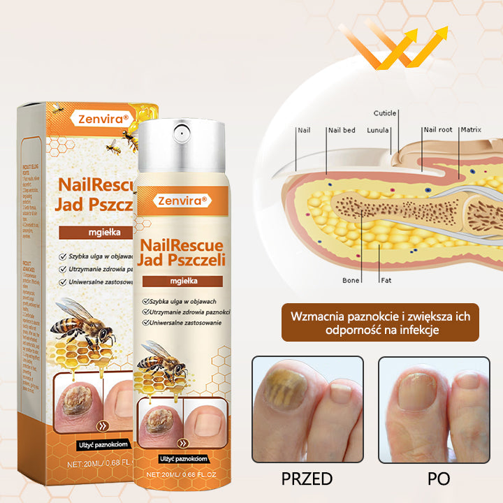 【Doporučeno odborníky】💛Zenvira® NailRescue Přírodní Sprej — ✅ Prokázaná účinnost proti lámavosti a žloutnutí nehtů během 7 dní!