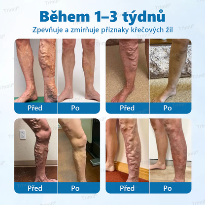 💙Trimil® VeinGuard Bylinný Sprej — ✅ Klinicky ověřeno, že dokáže zlepšit stav křečových žil už za pouhých 7 dní!