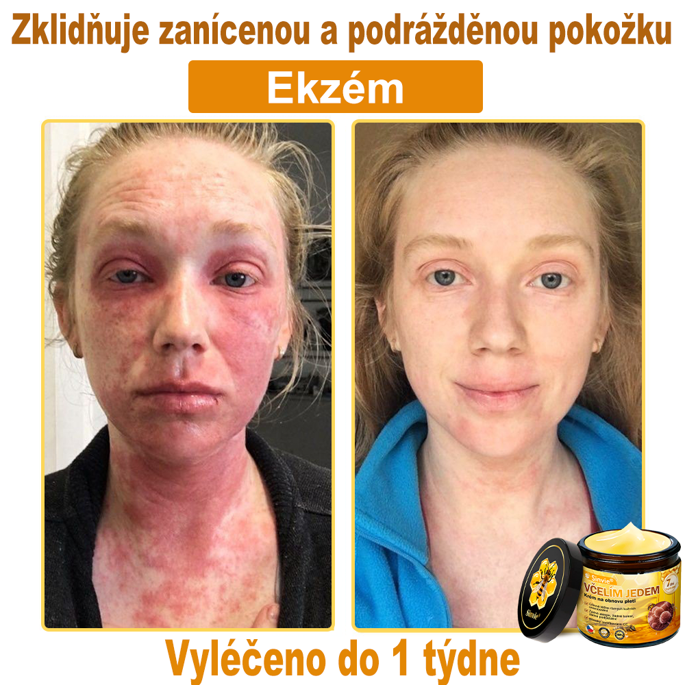 🐝 Sinvie® Krém na obnovu pleti s včelím jedem 👨‍⚕ Doporučeno dermatology ✅GMP schváleno - 50ml