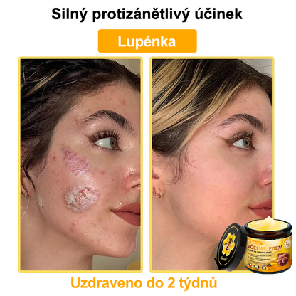 🐝 Sinvie® Krém na obnovu pleti s včelím jedem 👨‍⚕ Doporučeno dermatology ✅GMP schváleno - 50ml