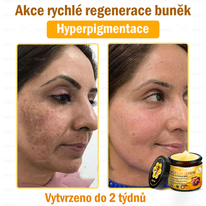 🌻 🌻Sinvie® Krém na obnovu pleti s včelím jedem 🔥 Doporučeno dermatology | Proti vráskám, pigmentovým skvrnám a ochablé pleti - 50 ml