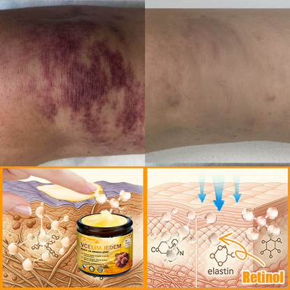 🐝 Sinvie® Krém na obnovu pleti s včelím jedem 👨‍⚕ Doporučeno dermatology ✅GMP schváleno - 50ml