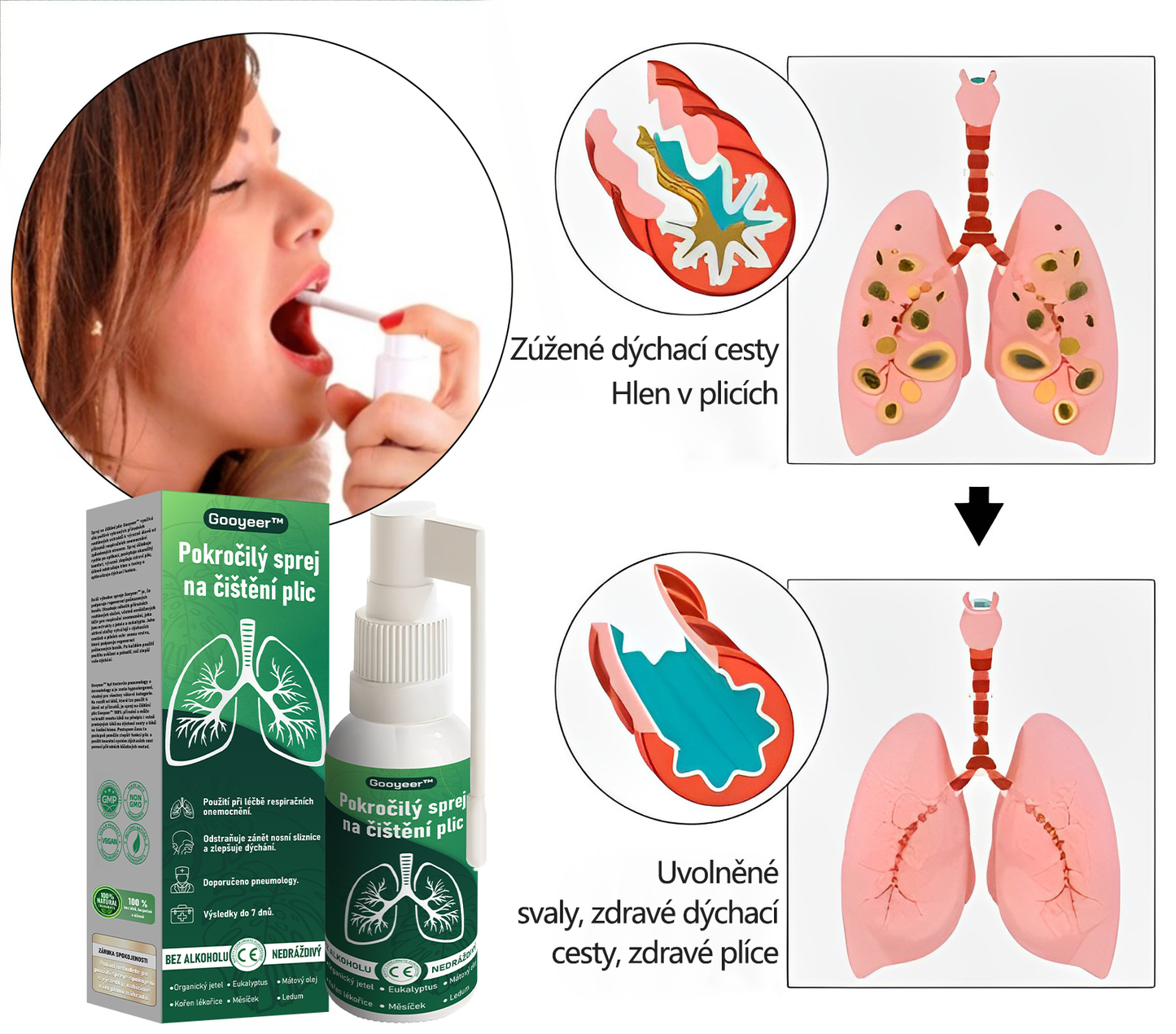 🍃𝐆𝐨𝐨𝐲𝐞𝐞𝐫™ Pokročilý sprej na čištění plic -🧑‍⚕️ Podporuje zdraví plic, průdušek a dutin, napomáhá zdraví dýchacího systému a usnadňuje dýchání.