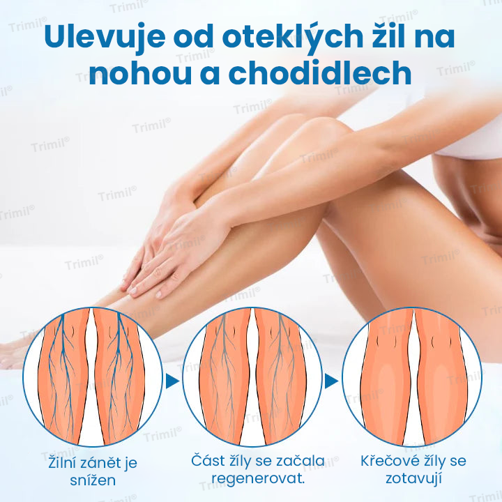 💙Trimil® VeinGuard Bylinný Sprej — ✅ Klinicky ověřeno, že dokáže zlepšit stav křečových žil už za pouhých 7 dní!