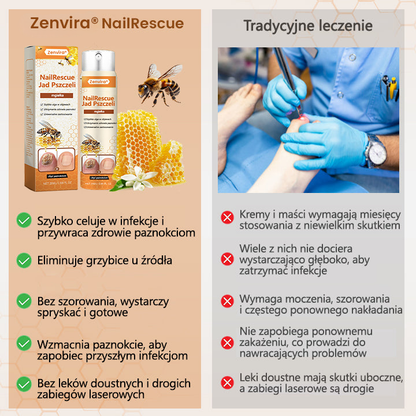 【Doporučeno odborníky】💛Zenvira® NailRescue Přírodní Sprej — ✅ Prokázaná účinnost proti lámavosti a žloutnutí nehtů během 7 dní!